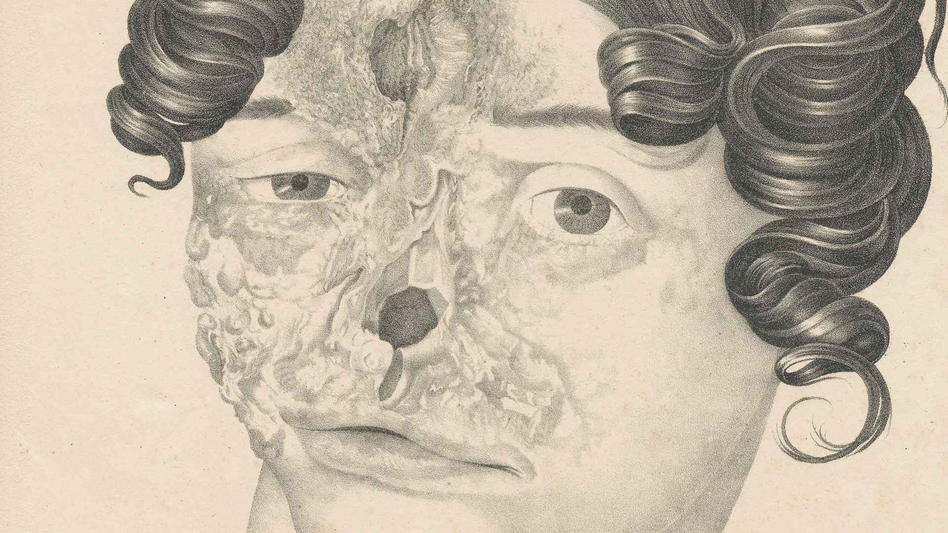 Sketch of woman with significant facial damage including to her nose