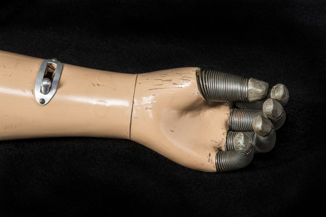 Prosthetic Arm